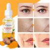 Turmeric Dark Spot Corrector Serum, Natural Turmeric Dark Spot Skin Care Moisturizing Repair Serum