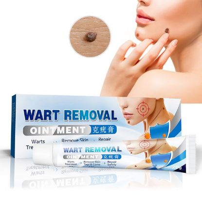 Wart Cream Gram Wart Cream Skin Care Flat Wart Ointment Wart Removal