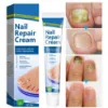 Toenail Fungus Treatment, Fungus Remover Toenail Repair