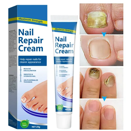 Toenail Fungus Treatment, Fungus Remover Toenail Repair