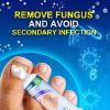 Toenail Fungus Treatment, Fungus Remover Toenail Repair