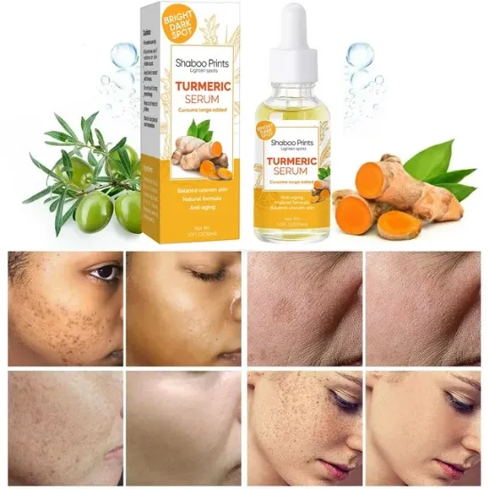 Turmeric Serum for Face Dark Spot Corrector, Face Skin Reduces Hyperpigmentation, Age Spots, Sun Spot, Improve Skin Tone