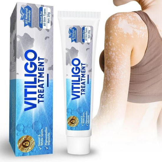 Picture of Vitiligo Cream, Vitiligo Treatment for Skin Vitiligo, Vitiligo Care Cream for Reduce White Spots and Improve Skin Pigmentation