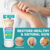 Hêrpes Genital Treatment, Relief Cream for Hêrpes Suffers, Gentle Treatment for Sensitive Skin