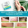 Psoriasis Cream, Scalp Treatment for Face and Body, Effective for Psoriasis, Folliculitis Treatment, Dry Scalp, Dandruff, Seborrheic Dermatitis Treatment, Herbal Anti Itch Cream Extra Strength