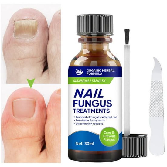 Picture of Toenail Fungus Treatment Extra Strength, Nail Fungus Treatment for Toenail & Fingernails, Nail Repair Solution for Thick Cracked Discolored Nails, Restore Healthy Nails
