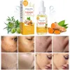Picture of Dark Spot Correcting Serum for Face, 30Ml