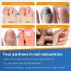 Picture of Toenail Fûngus Treatment Extra Strength 16PCS,Toenail Fûngus Treatment for Repairing Faded or Damaged Toenails,and Restores a Healthy Appearance of Toenails
