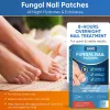 Picture of Toenail Fûngus Treatment Extra Strength 16PCS,Toenail Fûngus Treatment for Repairing Faded or Damaged Toenails,and Restores a Healthy Appearance of Toenails